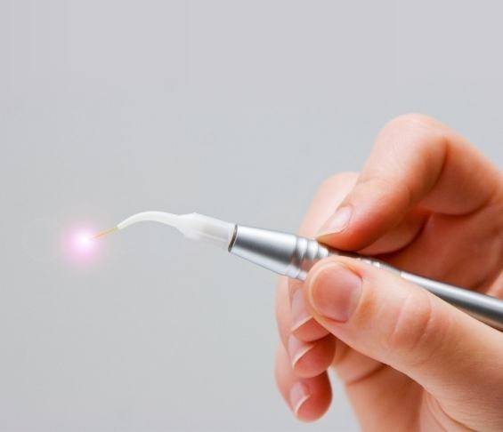 Hand holding a dental laser pen device