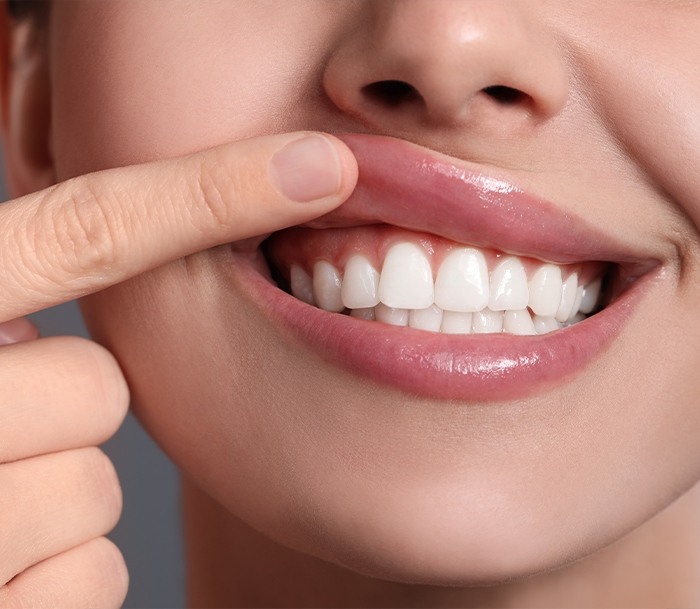 Close up of smiling person pointing to their tooth